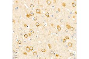 Immunohistochemistry of paraffin embedded rat brain using IP3R1 (ABIN7074293) at dilution of 1: 2400 (400x lens) (IP3 Receptor anticorps)