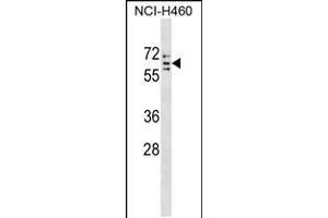 Western blot analysis in NCI-H460 cell line lysates (35ug/lane). (CYP4V2 anticorps  (C-Term))