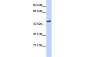 Image no. 1 for anti-Zinc Finger Protein 239 (ZNF239) (AA 108-157) antibody (ABIN6740511) (ZNF239 anticorps  (AA 108-157))