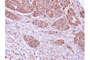 IHC-P Image Immunohistochemical analysis of paraffin-embedded NCIN87 xenograft, using DUSP7 , antibody at 1:100 dilution.