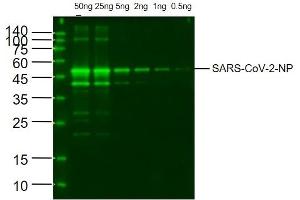 Western Blotting (WB) image for anti-SARS-CoV-2 Nucleocapsid (SARS-CoV-2 N) antibody (ABIN6952435)