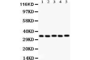 Western Blotting (WB) image for anti-Homeobox A11 (HOXA11) (AA 74-245) antibody (ABIN3042454) (Homeobox A11 anticorps  (AA 74-245))