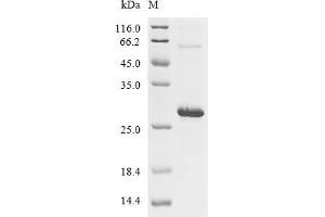 Pleiotrophin (PTN) (AA 31-165), (full length) protein (His tag)