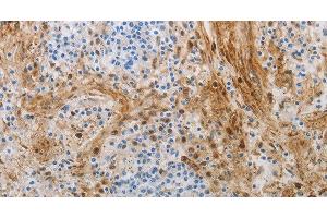 Immunohistochemistry of paraffin-embedded Human tonsil using NGFR Polyclonal Antibody at dilution of 1:50 (NGFR anticorps)