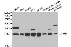 Western blot analysis of extracts of various cell lines, using DTYMK antibody.