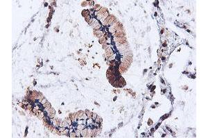 Image no. 3 for anti-IlvB (Bacterial Acetolactate Synthase)-Like (ILVBL) antibody (ABIN1498878) (ILVBL anticorps)