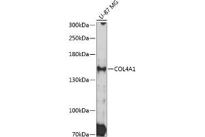 Western blot analysis of extracts of U-87 MG cells, using COL4 Antibody (0710) at 1:3000 dilution. (COL4A1 anticorps  (AA 1445-1669))