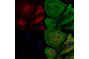 ABIN6262029 and ABIN6278157 staining  cells by IF/ICC. (GOLM1 anticorps  (C-Term))