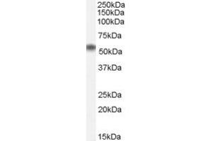 Western Blotting (WB) image for anti-ELMO/CED-12 Domain Containing 1 (ELMOD1) (N-Term) antibody (ABIN2156753) (ELMOD1 anticorps  (N-Term))