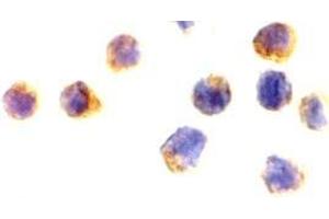 Immunocytochemistry of AIF?