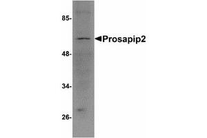 Image no. 1 for anti-TBK1 Binding Protein 1 (TBKBP1) (C-Term) antibody (ABIN478165) (TBKBP1 anticorps  (C-Term))