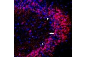 Expression of PICK1 in mouse hippocampus - Immunohistochemical staining of perfusion-fixed frozen mouse brain sections using Anti-PICK1 Antibody (ABIN7043566, ABIN7045156 and ABIN7045157), (1:400), followed by anti-rabbit-Cy3 antibody.