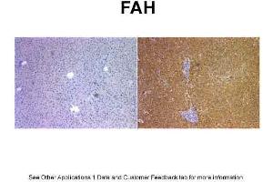 Sample Type: Human Liver and Mouse FAH KO liverPrimary Dilution: 1:400