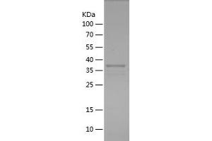 Western Blotting (WB) image for serpin Peptidase Inhibitor, Clade A (Alpha-1 Antiproteinase, Antitrypsin), Member 1 (SERPINA1) (AA 26-134) protein (His-IF2DI Tag) (ABIN7125047)