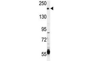 TRPM6 antibody western blot analysis in CEM lysate (TRPM6 anticorps  (AA 317-348))