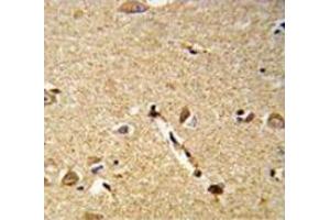 Immunohistochemistry anaysis of human brain tissue (Formalin-fixed, Paraffin-embedded) using DLL3  Antibody  (C-term), follwed by peroxidase-conjugated secondary antibody and DAB staining.