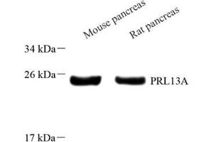 Western blot analysis of RPL13A (ABIN7075430) at dilution of 1: 800 (RPL13A anticorps)