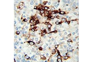 VIM antibody immunohistochemistry analysis in formalin fixed and paraffin embedded human prostate tissue.
