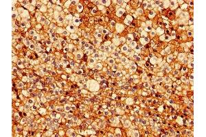 Immunohistochemistry of paraffin-embedded human adrenal gland tissue using ABIN7172771 at dilution of 1:100