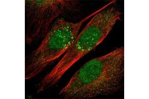 Immunofluorescence staining of U-251MG cell line with antibody shows positivity in nucleus and Golgi apparatus(green). (IL-18 anticorps)
