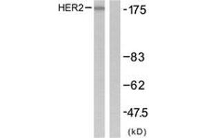 Western blot analysis of extracts from SK-OV3 cells, using HER2 (Ab-1221/1222) Antibody. (ErbB2/Her2 anticorps  (AA 1191-1240))