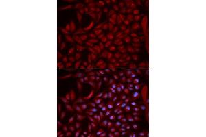 Immunofluorescence analysis of U2OS cells using CUL5 antibody (ABIN5973105). (Cullin 5 anticorps)