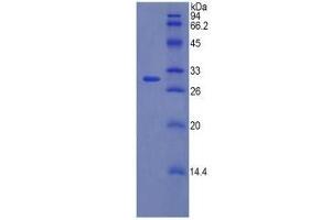 WB of Protein Standard: different control antibodies against Highly purified E.