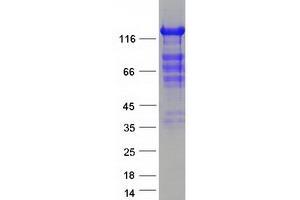 Validation with Western Blot