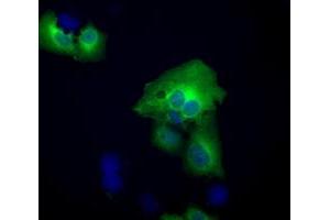 Image no. 10 for anti-Acetyl-CoA Acetyltransferase 2 (ACAT2) antibody (ABIN1496398)