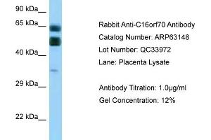 Western Blotting (WB) image for anti-Chromosome 16 Open Reading Frame 70 (C16orf70) (C-Term) antibody (ABIN2789391) (C16orf70 anticorps  (C-Term))