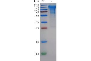 Human CD68 Protein, His Tag on SDS-PAGE under reducing condition.
