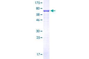 Image no. 1 for Chromosome 9 Open Reading Frame 72 (C9ORF72) (AA 1-481) protein (GST tag) (ABIN1347724)
