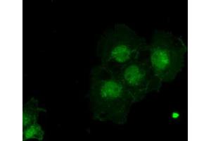 Immunofluorescence (IF) image for anti-alpha-Fetoprotein (AFP) (AA 19-397) antibody (ABIN2716009) (alpha Fetoprotein anticorps  (AA 19-397))
