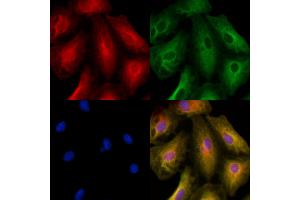 ABIN6257761 and ABIN6275829 staining  cells by IF/ICC.