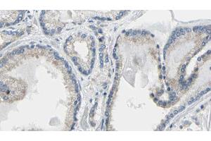 anti-Calreticulin (CALR) (N-Term) antibody