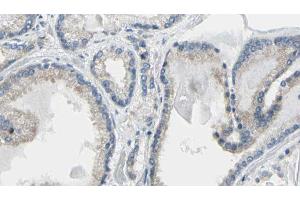 ABIN6274218 at 1/100 staining Human prostate tissue by IHC-P. (Calreticulin anticorps  (N-Term))
