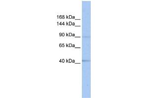 WB Suggested Anti-SENP6  Antibody Titration: 0.