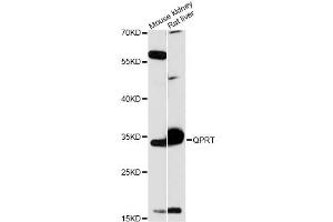 Western blot analysis of extracts of various cell lines, using QPRT antibody (ABIN6290813) at 1:3000 dilution.
