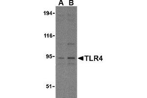 Western Blotting (WB) image for anti-Toll-Like Receptor 4 (TLR4) (N-Term) antibody (ABIN1031622) (TLR4 anticorps  (N-Term))