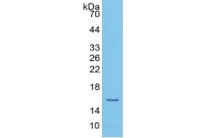 WB of Protein Standard: different control antibodies against Highly purified E. (Histone H4 Kit ELISA)