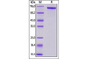 Transferrin (TF) (AA 20-697) protein (Fc Tag)