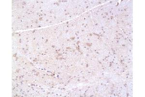 Formalin-fixed and paraffin embedded: rat brain tissue labeled with Anti-PMP22 Polyclonal Antibody, Unconjugated  at 1:200, followed by conjugation to the secondary antibody and DAB staining (PMP22 anticorps  (AA 101-160))