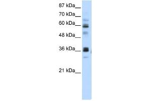 RPUSD2 antibody used at 5 ug/ml to detect target protein. (RPUSD2 anticorps  (N-Term))