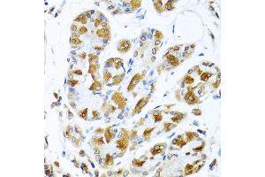 Immunohistochemistry of paraffin-embedded human stomach using PIAS3 antibody at dilution of 1:100 (40x lens).