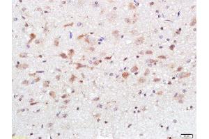 Paraformaldehyde-fixed, paraffin embedded (Species/Tissue), Antigen retrieval by boiling in sodium citrate buffer (pH6) for 15min, Block endogenous peroxidase by 3% hydrogen peroxide for 30 minutes, Blocking buffer (normal goat serum) at 37°C for 20min, Antibody incubation with Calcium Sensing Receptor Polyclonal Antibody, Unconjugated  at 1:500 overnight at 4°C, followed by a conjugated secondary and DAB staining. (CASR anticorps  (AA 121-220))