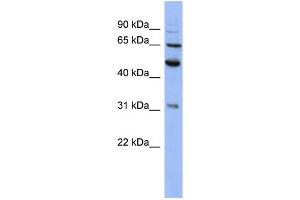 WB Suggested Anti-PSMD3 Antibody Titration: 0.
