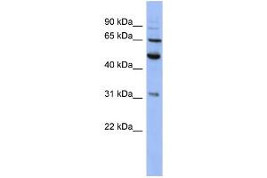 WB Suggested Anti-PSMD3 Antibody Titration: 0. (PSMD3 anticorps  (N-Term))