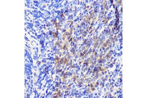 Immunohistochemistry of paraffin-embedded Mouse spleen using  Rabbit pAb (ABIN6133192, ABIN6137243, ABIN6137244 and ABIN6223255) at dilution of 1:100 (40x lens).