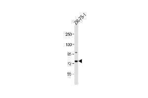 Anti-CTTNBP2NL Antibody (N-term) at 1:1000 dilution + ZR-75-1 whole cell lysate Lysates/proteins at 20 μg per lane. (CTTNBP2NL anticorps  (N-Term))