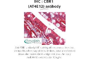 Image no. 1 for anti-Carbonyl Reductase 1 (CBR1) antibody (ABIN1724380) (CBR1 anticorps)